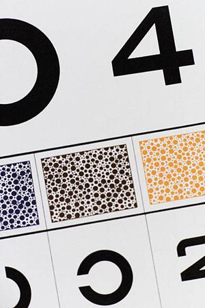 歯科医院のホワイトニングがおすすめ