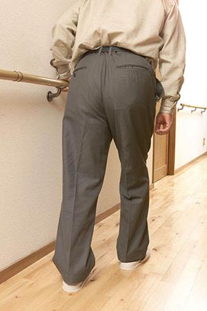 赤あざを効果的に解消する方法とは？最適なレーザー治療のポイントを解説